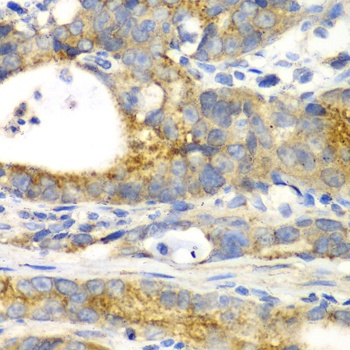 GORASP1 Antibody