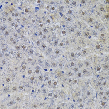 SNRPA Antibody