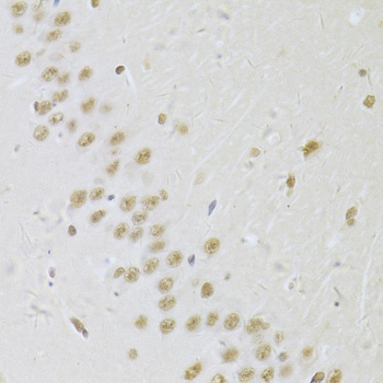 SNRPA Antibody