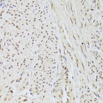 SNRPA Antibody
