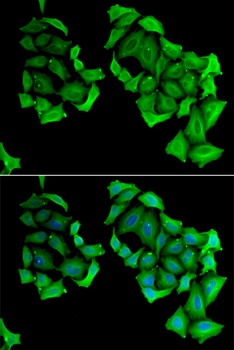 C4BPB Antibody