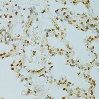 RCC1 Antibody