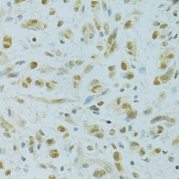 RCC1 Antibody