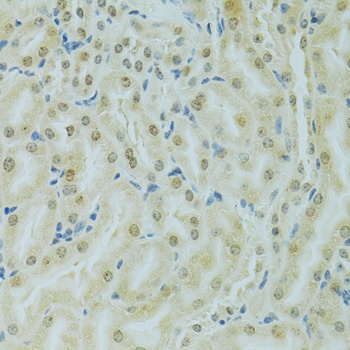 RCC1 Antibody