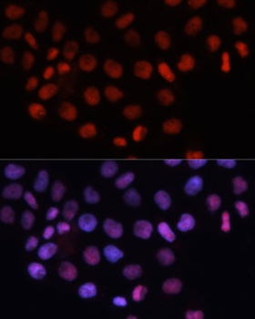 RCC1 Antibody