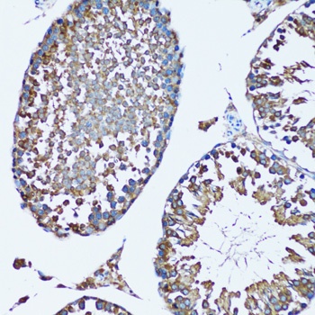 FDFT1 Antibody