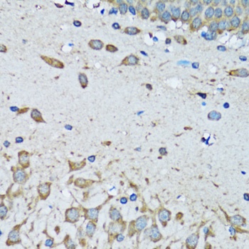 FDFT1 Antibody