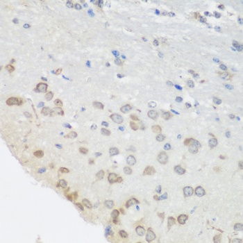 PUM1 Antibody