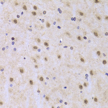 ILF2 Antibody