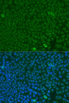 FBXW7 Antibody