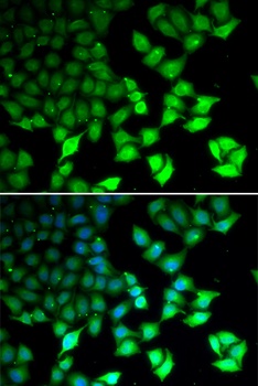 KDM4B Antibody