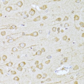 FDPS Antibody