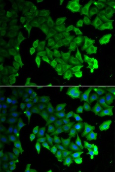 MAP1LC3A/MAP1LC3B Antibody