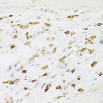 LSP1 Antibody