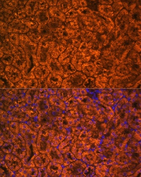 SCNN1A Antibody