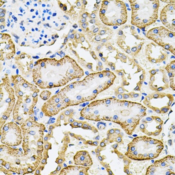 SLC4A4 Antibody