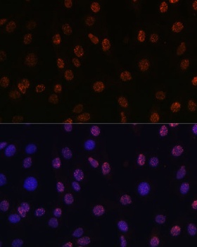 DiMethyl-Histone H3-K14 pAb