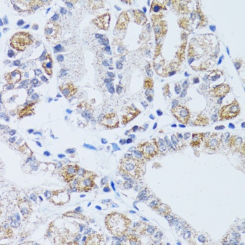 DNAJC19 Antibody