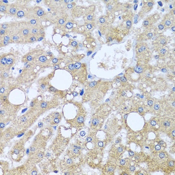 TUBGCP3 Antibody