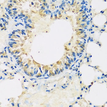 ABCF2 Antibody
