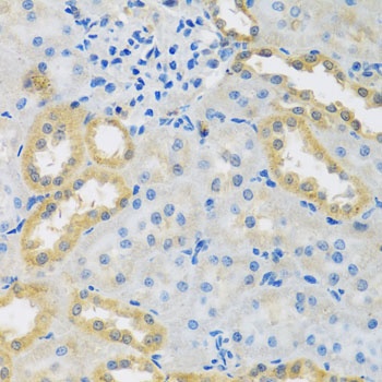 PMPCB Antibody