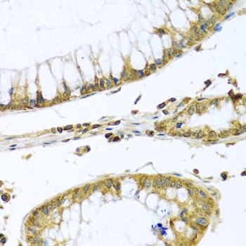 PMPCB Antibody