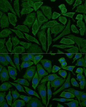 NDUFB2 Antibody