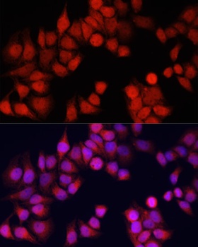 CSTB Antibody