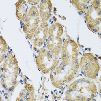 CAMK2G Antibody