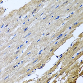 CAMK2G Antibody