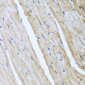 CAMK2G Antibody