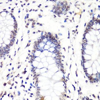 H3R2me2a Antibody