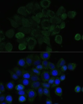 CDH1 Antibody