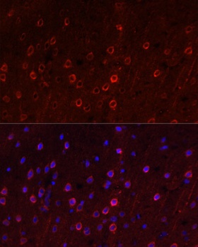 SLC1A1 Antibody