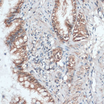 AQP4 Antibody