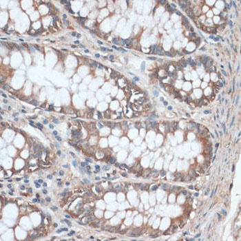 AQP4 Antibody