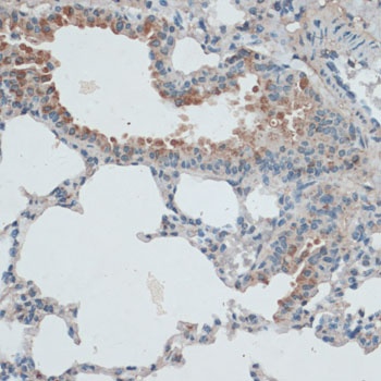 AQP4 Antibody