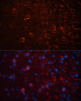 AQP4 Antibody