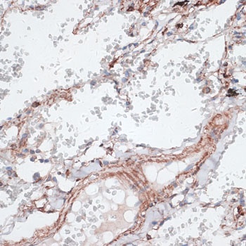 VIM Antibody
