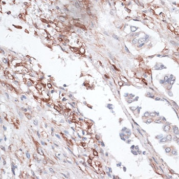 VIM Antibody