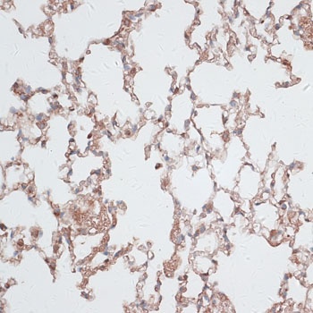 VIM Antibody