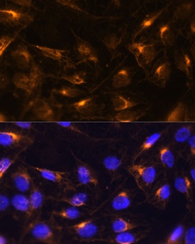 VIM Antibody