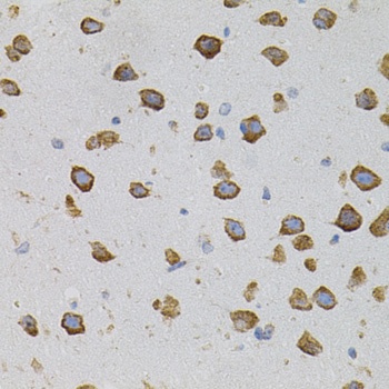 VEGFC Antibody