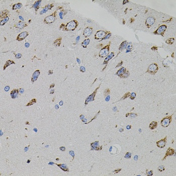 VEGFC Antibody