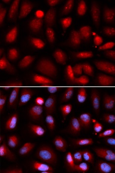 RELA Antibody