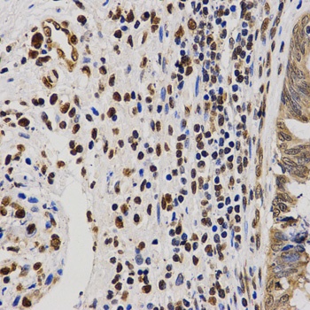 H4R3me2a Antibody