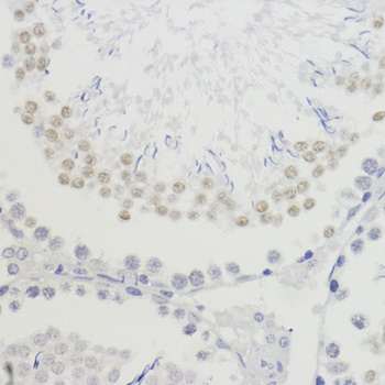 H4K20me3 Antibody