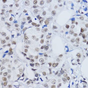 DiMethyl-Histone H3-K79 pAb