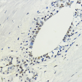 H3K36me3 Antibody