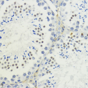 H3K36me3 Antibody